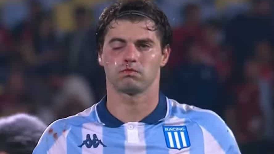 Santiago Sosa levou a pior em dividida com o próprio companheiro - Foto: Reprodução/TV Globo